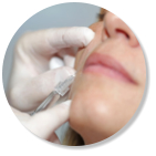 Faltenunterspritzung